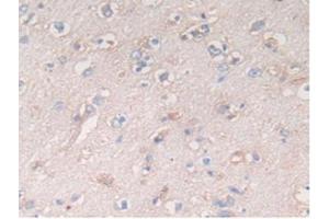 IHC-P analysis of Human Brain Tissue, with DAB staining. (ATF6 antibody  (AA 423-646))