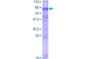 SLC6A3 Protein (AA 1-620) (GST tag)