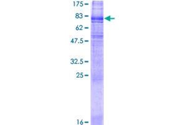 SLC6A3 Protein (AA 1-620) (GST tag)