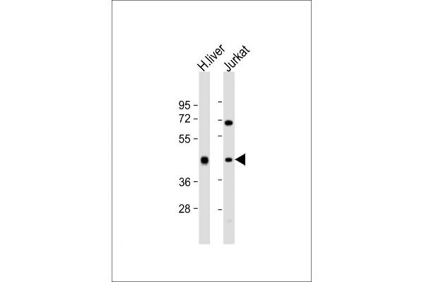 ADH1B anticorps  (AA 209-237)