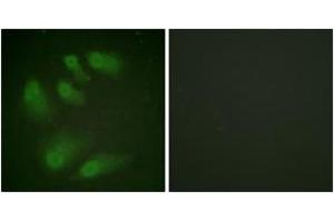 Immunofluorescence analysis of HeLa cells, using Chk1 (Phospho-Ser286) Antibody. (CHEK1 antibody  (pSer286))