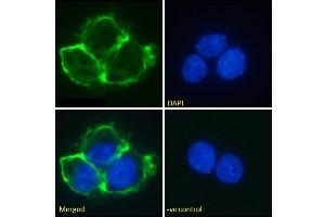 Immunofluorescence staining of fixed A431 cells with anti-EGFR antibody Matuzumab. (Recombinant EGFR (Matuzumab Biosimilar) antibody  (Extracellular Domain))