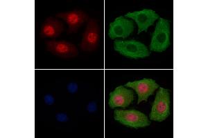 ABIN6256342 and ABIN6267479 staining Hela cells(4h of LPS treatment) by IF/ICC. (beta Catenin antibody  (pSer45, pThr41))