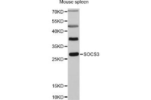 Western blot analysis of extracts of mouse spleen, using SOCS3 antibody (ABIN5970268) at 1:3000 dilution. (SOCS3 antibody)