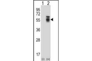 Western blot analysis of ACVR1 (arrow) using rabbit polyclonal ACVR1 Antibody (Center) (ABIN657777 and ABIN2846752). (ACVR1 antibody  (AA 132-161))