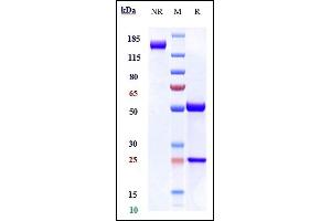 Anti-DLL4 Reference Antibody (navicixizumab) on SDS-PAGE under reducing (R) condition. (Recombinant DLL4 (Navicixizumab Biosimilar) antibody)