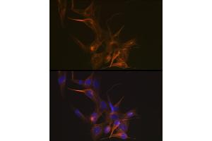 Immunofluorescence analysis of NIH-3T3 cells using Tubulin beta-1 chain Rabbit mAb (ABIN7271045) at dilution of 1:100 (40x lens). (TUBB1 antibody)