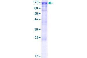 CWC22 Protein (AA 1-908) (GST tag)