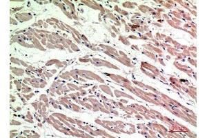 Immunohistochemistry (IHC) analysis of paraffin-embedded Human Heart, antibody was diluted at 1:200. (Macrophage Mannose Receptor 1 antibody  (Internal Region))