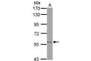 Image no. 2 for anti-Aldehyde Dehydrogenase 6 Family, Member A1 (ALDH6A1) (AA 1-255) antibody (ABIN1496604) (ALDH6A1 antibody  (AA 1-255))