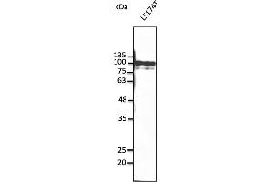 Western Blotting (WB) image for anti-PTK2 Protein tyrosine Kinase 2 (PTK2) (C-Term) antibody (ABIN7272980) (FAK antibody  (C-Term))