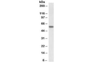 Western blot testing of human skeletal muscle lysate with DIXDC1 antibody at 0. (DIXDC1 antibody)