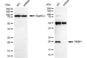 Western blotting analysis using PEBP1 antibody (ABIN7799791).