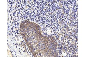 Immunohistochemistry analysis of paraffin-embedded human tonsil using PERK Polyclonal Antibody at dilution of 1:400. (PERK antibody)