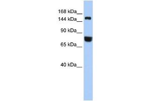WB Suggested Anti-EEA1  Antibody Titration: 0. (EEA1 antibody  (Middle Region))