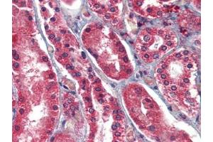 Human Kidney: Formalin-Fixed, Paraffin-Embedded (FFPE) (AIF antibody  (AA 593-606))