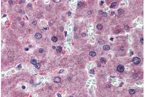 Liver, Human: Formalin-Fixed, Paraffin-Embedded (FFPE) (HYAL1 antibody  (AA 36-85))