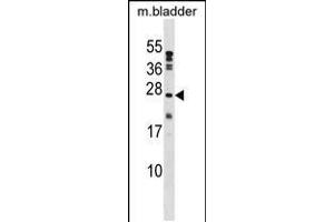 Western blot analysis in mouse bladder tissue lysates (35ug/lane). (PTP4A1 antibody  (C-Term))