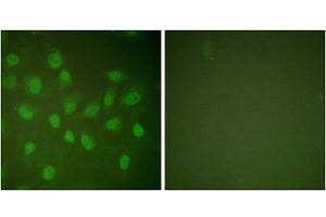 Immunofluorescence analysis of HeLa cells, treated with PMA (125ng/ml, 30mins), using POLR2A (epitope around residue 1619) antibody (ABIN5976162). (POLR2A/RPB1 antibody  (Ser1619))