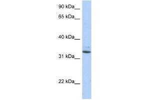SULT1A1 antibody used at 1 ug/ml to detect target protein. (SULT1A1 antibody  (N-Term))