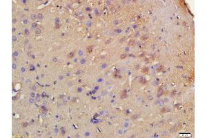 Formalin-fixed and paraffin embedded rat brain labeled with Rabbit Anti-HRH3/GPCR97 Polyclonal Antibody, Unconjugated 1:200 followed by conjugation to the secondary antibody and DAB staining (HRH3 antibody  (AA 121-220))