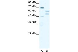 WB Suggested Anti-ZNF297B Antibody Titration: 5. (ZBTB43 antibody  (N-Term))