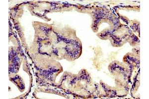 IHC image of ABIN7144136 diluted at 1:400 and staining in paraffin-embedded human prostate tissue performed on a Leica BondTM system. (AGT antibody  (AA 44-427))