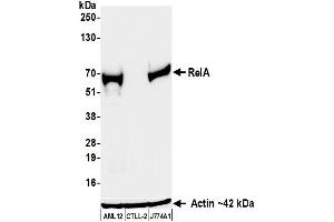 Western Blotting (WB) image for anti-Nuclear Factor-kB p65 (NFkBP65) (C-Term) antibody (ABIN7795799) (Recombinant NF-kB p65 antibody  (C-Term))