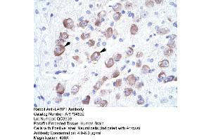 Human Brain (LARP1B antibody  (Middle Region))