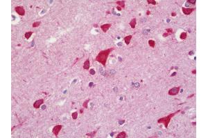 Anti-MYD88 antibody IHC staining of human brain, cortex. (MYD88 antibody)