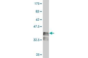 Western Blot detection against Immunogen (37 KDa) . (LHX4 antibody  (AA 291-390))