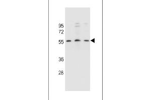 KCNK18 Antibody (Center) (ABIN657542 and ABIN2846557) western blot analysis in SiHa,,MCF-7 cell line lysates (35 μg/lane). (KCNK18 antibody  (AA 168-197))