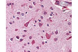 Anti-MCL1 antibody IHC of human brain, cortex.