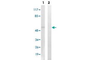 Western blot analysis of Lane 1: Untreated K562 cell lysates, Lane 2: Synthesized peptide treated K562 cell lysates reacted with AKT1/AKT3 (phospho Y437/Y434) polyclonal antibody  at 1:500-1:3000 dilution. (AKT1/3 (pTyr437), (Tyr434) antibody)