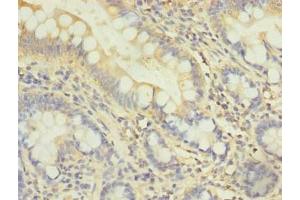 Immunohistochemistry of paraffin-embedded human small intestine tissue using ABIN7163345 at dilution of 1:100 (DDHD2 antibody  (AA 361-650))