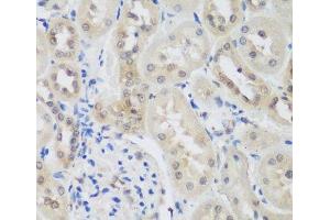 Immunohistochemistry of paraffin-embedded Rat kidney using UBE3A Polyclonal Antibody at dilution of 1:200 (40x lens). (ube3a antibody)