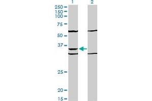 Western Blot analysis of PAX9 expression in transfected 293T cell line by PAX9 monoclonal antibody (M03), clone 4B9. (PAX9 antibody  (AA 205-300))