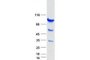 Validation with Western Blot