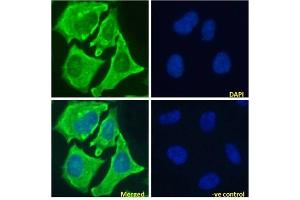 Immunofluoresence staining of fixed HeLa cells with anti-Notch 1 antibody E6. (Recombinant Notch1 antibody)