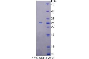 Image no. 1 for Recoverin (RCVRN) (AA 2-200) protein (His tag) (ABIN6238054)