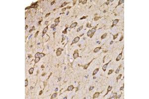 Immunohistochemistry of paraffin-embedded mouse brain using RPS14 antibody at dilution of 1:100 (x400 lens). (RPS14 antibody)