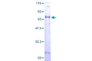 Acad8 Protein (AA 1-415) (GST tag)