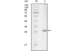 Western blot analysis using ITK mouse mAb against truncated Trx-ITK recombinant protein (1). (ITK antibody  (AA 2-110))