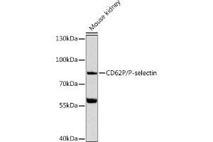 Western blot analysis of extracts of mouse kidney, using CD62P/P-selectin Antibody (ABIN6131512, ABIN6147501, ABIN6147504 and ABIN6216152) at 1:1000 dilution. (P-Selectin antibody  (AA 220-319))