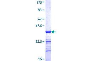 EVI2B Protein (AA 23-121) (GST tag)