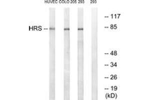 Western blot analysis of extracts from 293/COLO/HuvEc cells, using HRS (Ab-334) Antibody. (HRS (HRS) (AA 301-350) antibody)