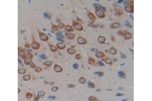 #VALUE! (CD99 antibody  (AA 26-160))