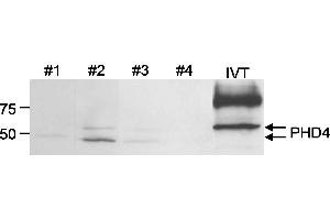 Western Blotting (WB) image for anti-Prolyl 4-Hydroxylase, Transmembrane (Endoplasmic Reticulum) (P4HTM) (C-Term) antibody (ABIN7449275) (P4HTM antibody  (C-Term))