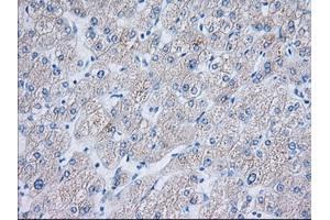 Immunohistochemical staining of paraffin-embedded Human liver tissue using anti-TTC32 mouse monoclonal antibody. (TTC32 antibody)