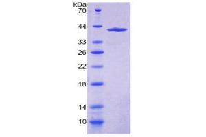 SDS-PAGE (SDS) image for Myosin VA (MYO5A) (AA 1531-1855) protein (His tag) (ABIN2126012)
